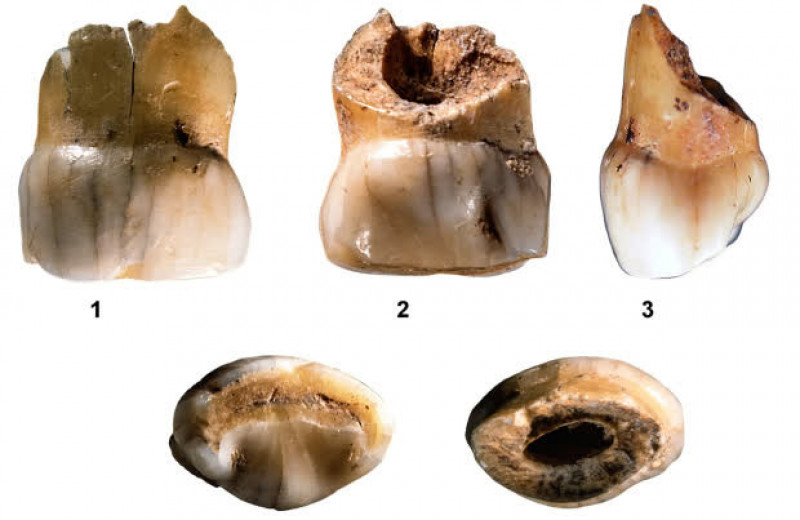Три молочных зуба из испанской пещеры оказались неандертальскими