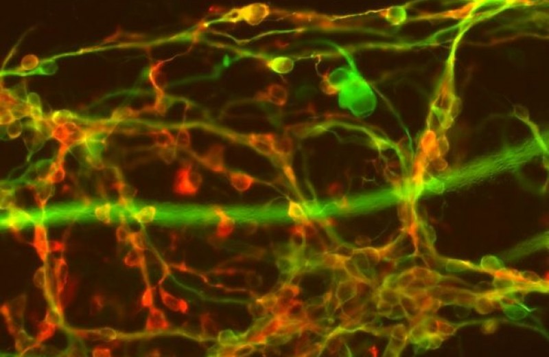 Инъекция стволовых клеток в мозг затормозила болезнь Паркинсона