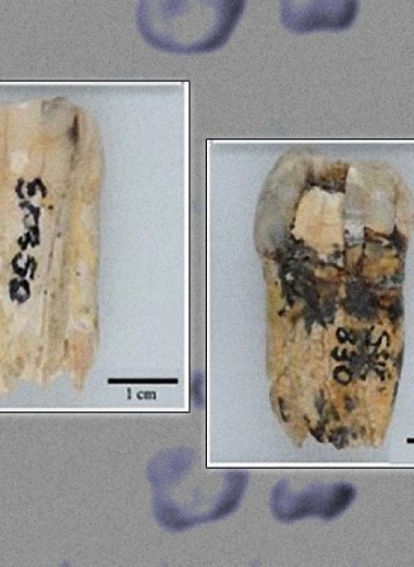 Пол гоминин возрастом более двух миллионов лет установили по белкам зубной эмали