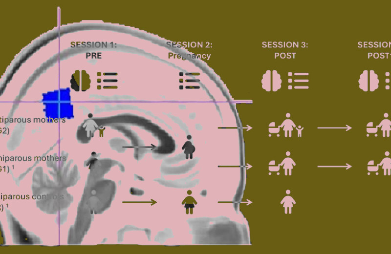 Вторая беременность повлияла на активность сети пассивной работы мозга