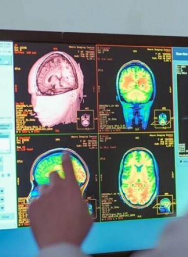 Мозг взрослеет до 32 лет: ученые выделили пять фаз его развития