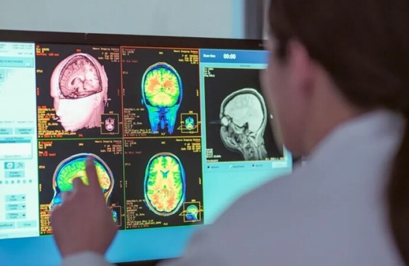 Мозг взрослеет до 32 лет: ученые выделили пять фаз его развития