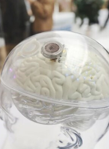 Китай первым в мире разрешил массовое использование нейроимпланта NEO