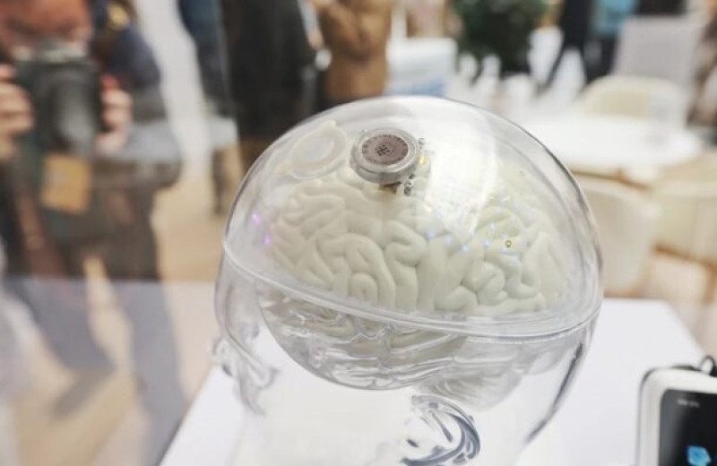 Китай первым в мире разрешил массовое использование нейроимпланта NEO