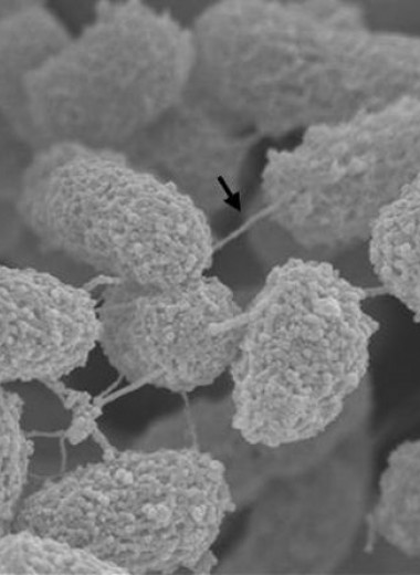 Попытка защититься от бактериофагов вернула бактерии чувствительность к антибиотикам