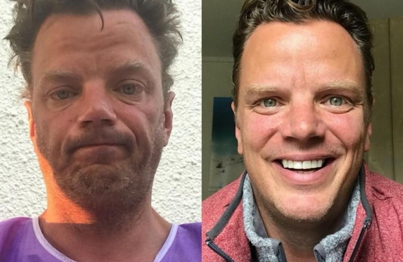 До и после: 16 преображений людей после того, как они бросили пить