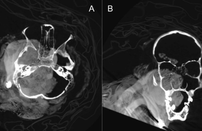 Инки поманипулировали с мумией жертвы капакочи