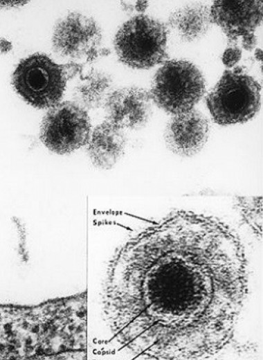 Белок герпесвируса связали с развитием депрессии
