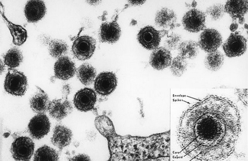Белок герпесвируса связали с развитием депрессии