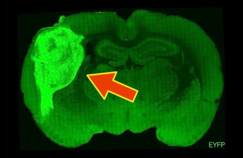 Ученые имплантировали фрагменты мозга человека в новорожденных крыс