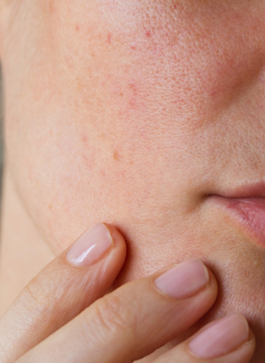 Какие нарушения в организме влияют на кожу лица