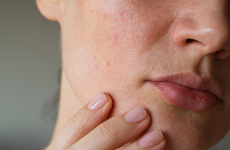Какие нарушения в организме влияют на кожу лица