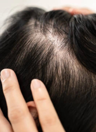 Восстановление волос после болезни и стресса: что действительно работает и как быстро