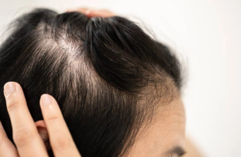 Восстановление волос после болезни и стресса: что действительно работает и как быстро