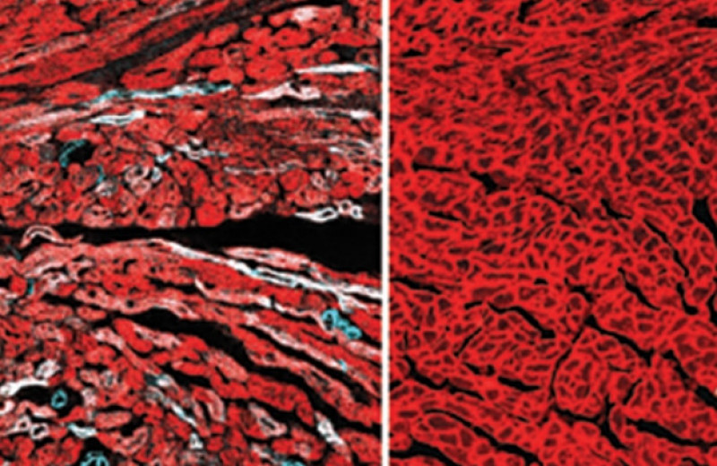 Репрограммирование клеток частично восстановило сердце мышей после инфаркта
