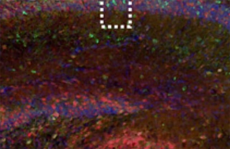 Возбуждающие нейроны гиппокампа мышей превратились в тормозные при взрослении