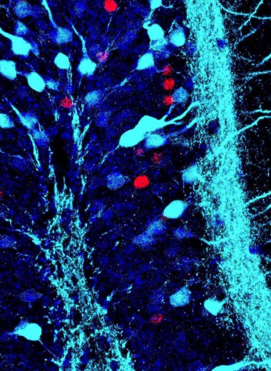 Нейроны с позитивными и негативными воспоминаниями «светятся» по-разному. Новый метод лечения депрессии