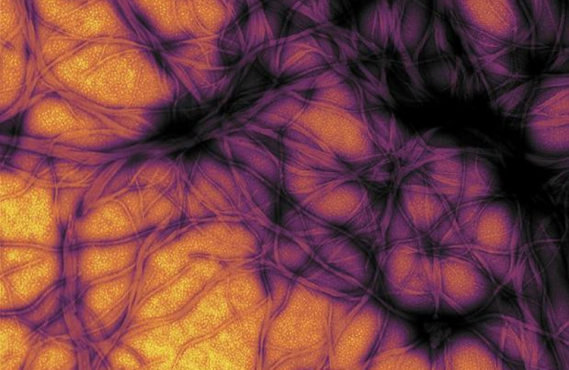Нейробиологи впервые предотвратили трансформацию прионов в патогенную форму