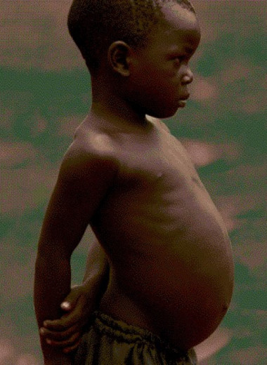 80 процентов детских смертей в Африке и Южной Азии оказались предотвратимы