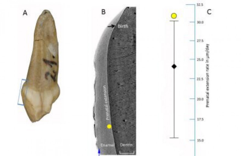 Неандертальцы могли быстрее стареть: гипотеза выросла из древнего молочного зуба