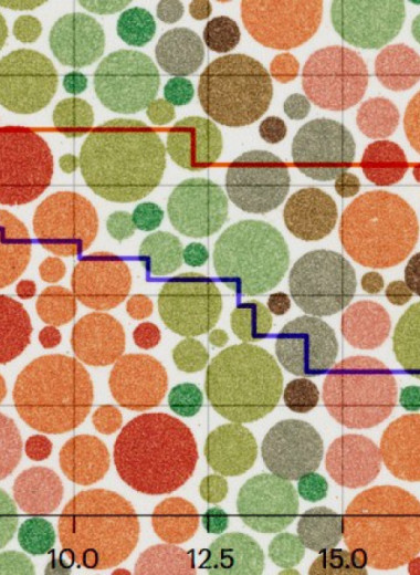 Нарушения цветового зрения ухудшили выживаемость при раке мочевого пузыря