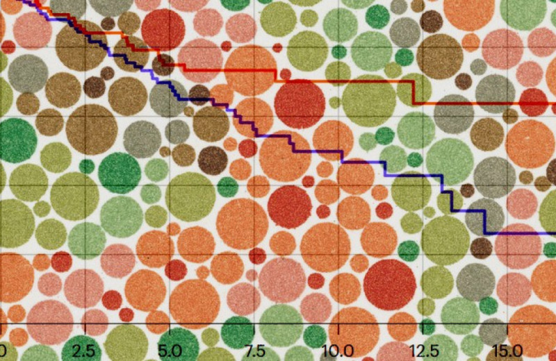Нарушения цветового зрения ухудшили выживаемость при раке мочевого пузыря