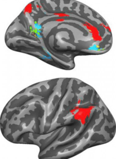 Люди задействовали разные части мозга при мыслях о близком круге и остальных знакомых