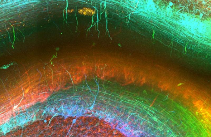 Краска для мозгов: новая разработка нейробиологов