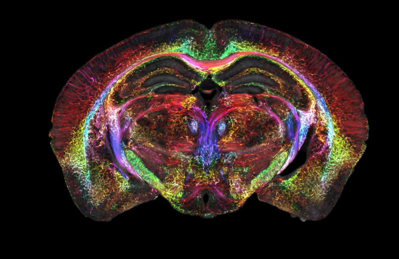 В 64 миллиона раз нейробиологи увеличили разрешение МРТ-снимков мозга