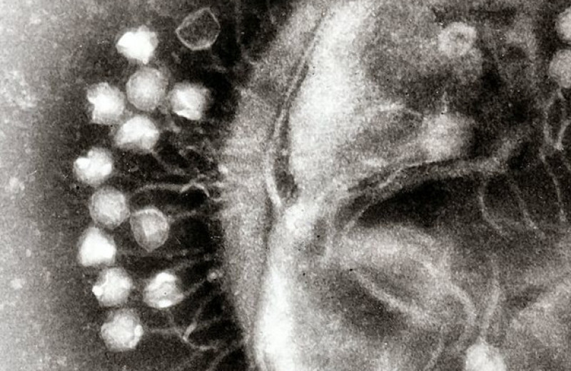 Антитела против бактериофагов помешали им вылечить инфекцию