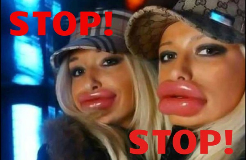 Девушки, перестаньте накачивать губы!