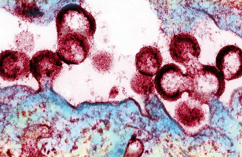 У ВИЧ-инфицированной пациентки заподозрили естественное избавление от вируса