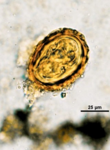 В палеофекалиях древних добытчиков соли нашли яйца гельминтов