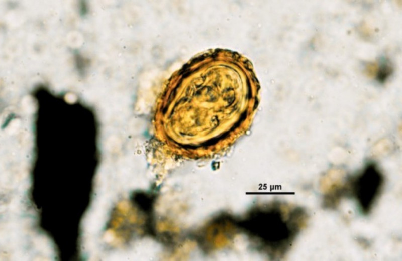 В палеофекалиях древних добытчиков соли нашли яйца гельминтов