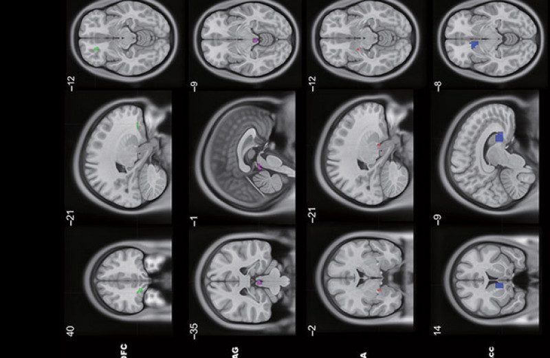 Функциональная МРТ указала на два пути формирования алкоголизма в мозге подростков