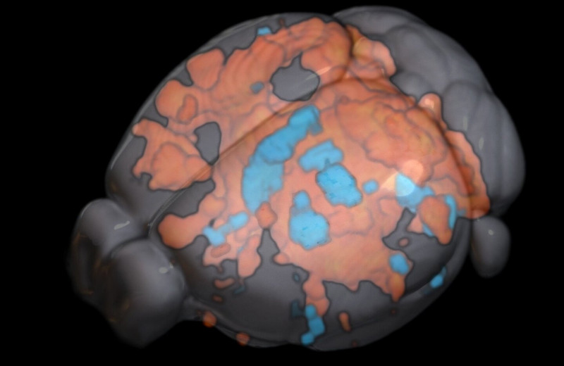 Новый метод фМРТ поможет объяснить, как работает глубокая стимуляция мозга при лечении расстройств и зависимостей