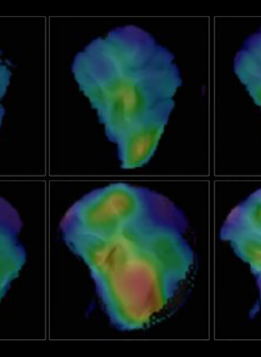 Эпигенетическую регуляцию в мозге увидели с помощью диеты и МРТ