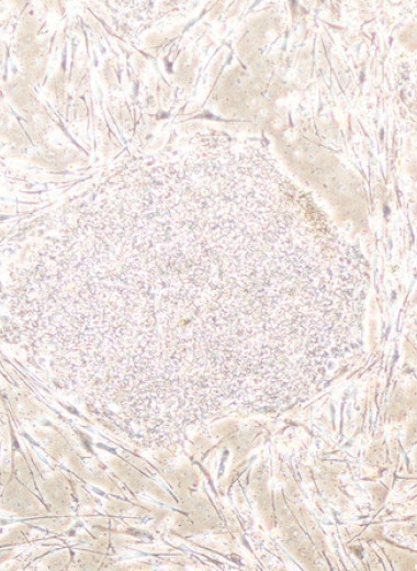 Стволовые клетки пообщались мембранными пузырьками с РНК