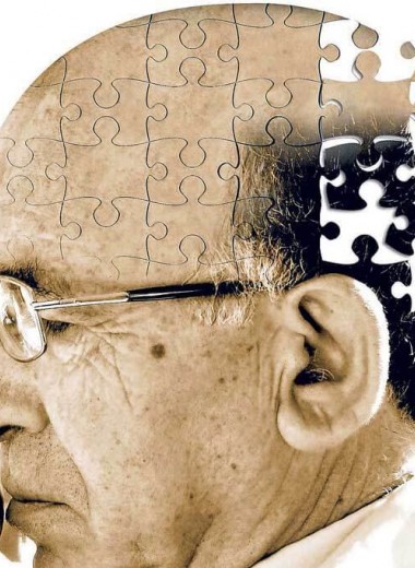 Что такое болезнь Альцгеймера и почему люди заболевают слабоумием