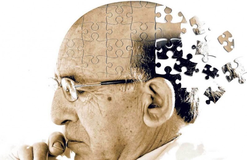 Что такое болезнь Альцгеймера и почему люди заболевают слабоумием