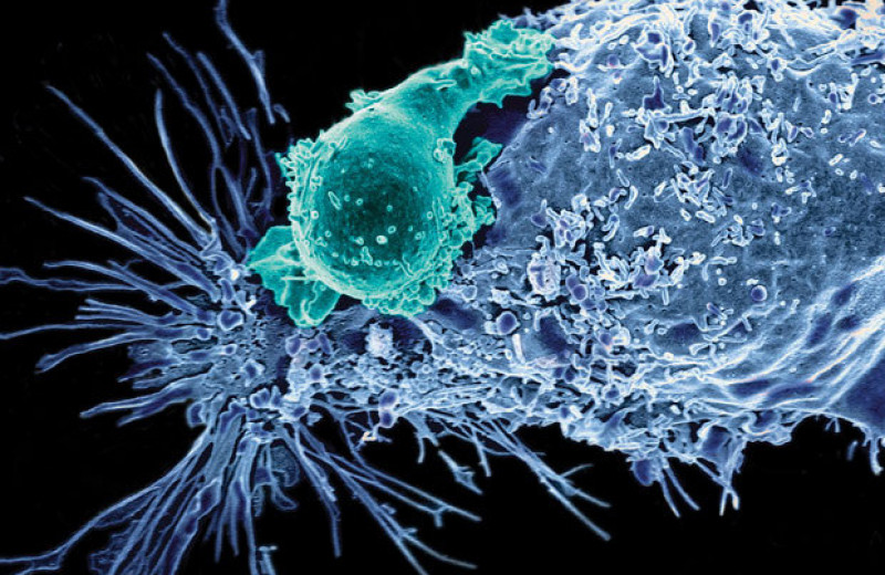 Борьба с истощением CAR-Т-лимфоцитов повысила эффективность иммунотерапии рака