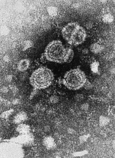 Шесть охотников-собирателей из Сибири подхватили вирус гепатита B более 9600 лет назад