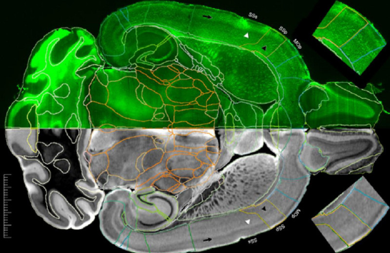 Как будто на айфон сняли: ученые получили самый подробный МРТ-снимок мозга