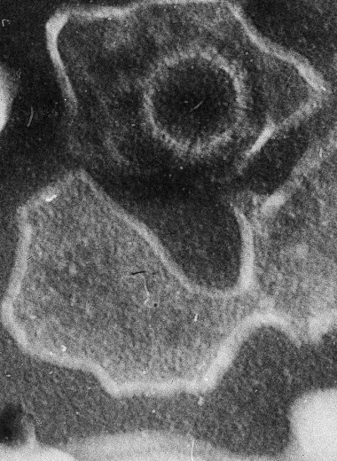 Ученые показали нуклеазную функцию необходимого вирусу Эпштейна — Барр белка