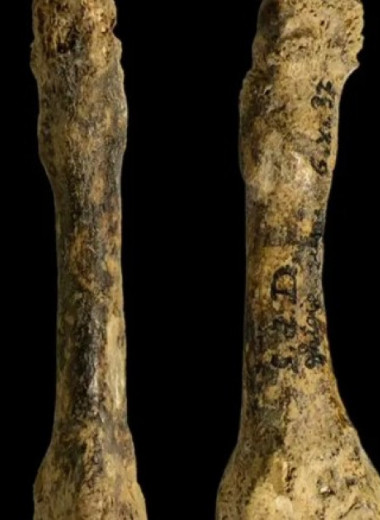 Человек гейдельбергский получил стрессовый перелом около 300 тысяч лет назад