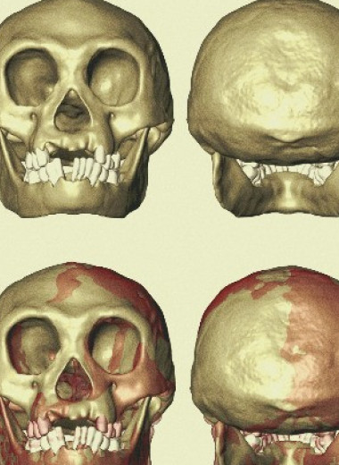 Антропологи выяснили биомеханику черепа карликовых людей с Флореса