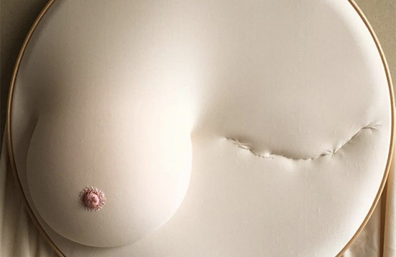 «Чувствую себя раненой, но не побежденной»: рассказ о раке груди от первого лица