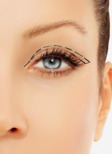 Как ухаживать за кожей вокруг глаз и когда необходима блефаропластика