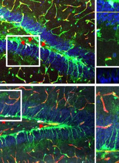 Стволовые клетки мозга обманули гематоэнцефалический барьер