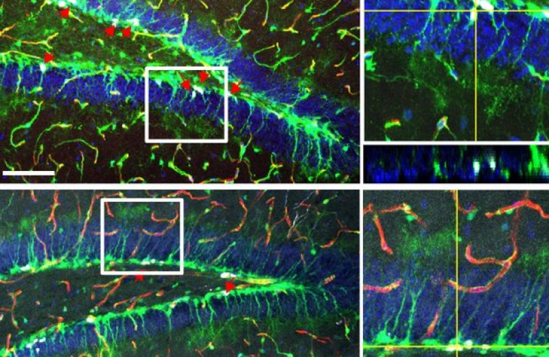 Стволовые клетки мозга обманули гематоэнцефалический барьер